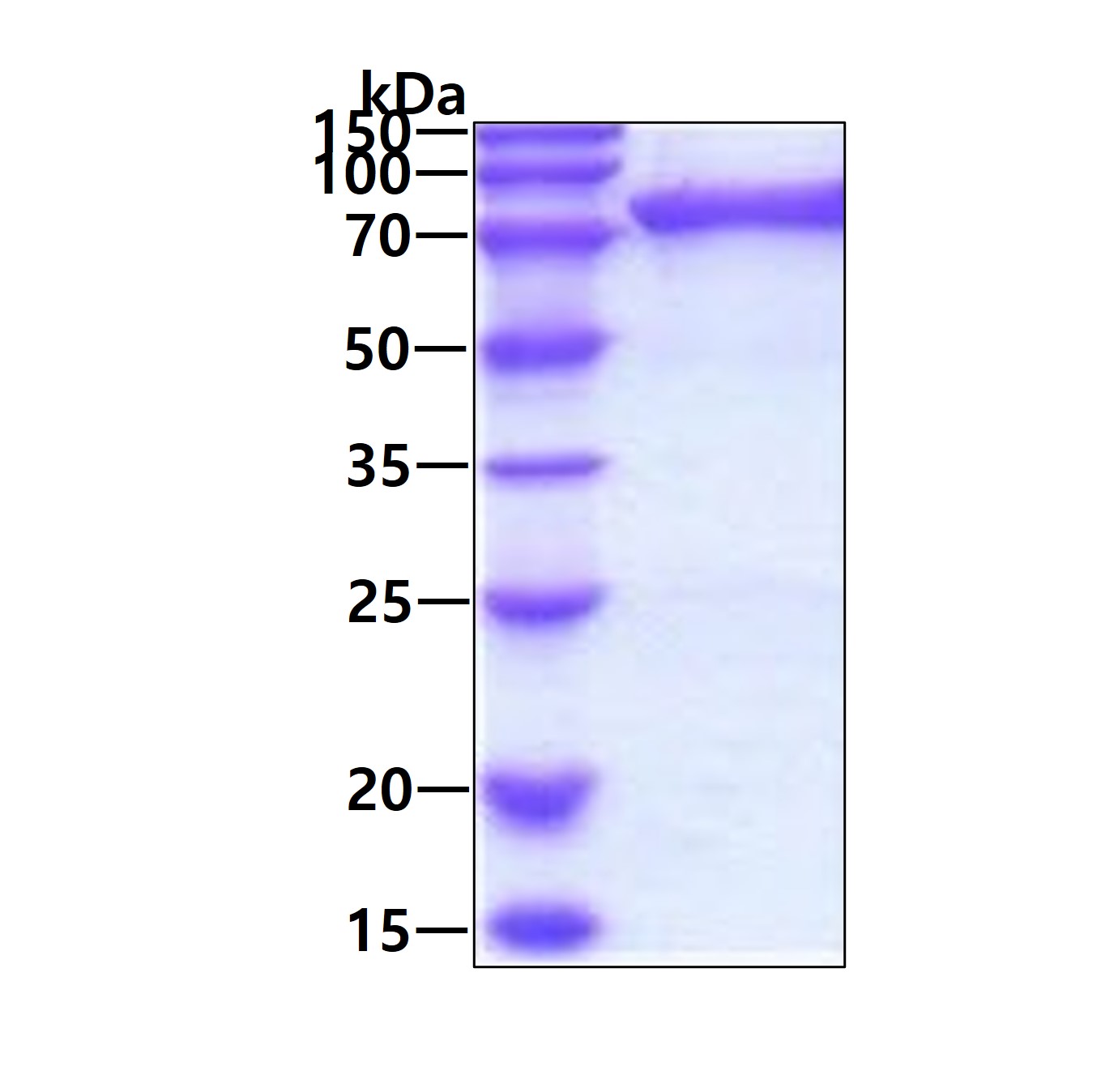 3 μg by SDS-PAGE under reducing condition and visualized by coomassie blue stain.